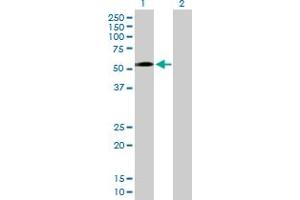 Western Blot analysis of ZNF563 expression in transfected 293T cell line by ZNF563 MaxPab polyclonal antibody. (ZNF563 抗体  (AA 1-476))