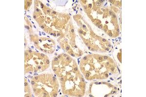 Immunohistochemistry of paraffin-embedded human kidney using PRKAG3 antibody (ABIN5975719) at dilution of 1/100 (40x lens). (PRKAG3 抗体)