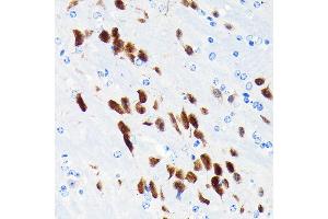 Immunohistochemistry of paraffin-embedded mouse brain using NeuN Rabbit mAb (ABIN7270098) at dilution of 1:100 (40x lens). (NeuN 抗体)