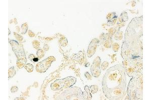 ABIN6264780 and ABIN6273155 at 1/100 staining human normal placenta tissue by IHC-P. (RND3 抗体  (Internal Region))