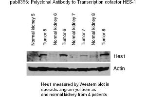 Image no. 1 for anti-Hes Family bHLH Transcription Factor 1 (HES1) (C-Term) antibody (ABIN347373) (HES1 抗体  (C-Term))