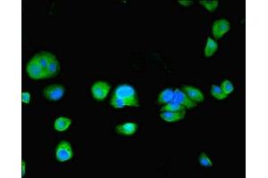 Immunofluorescent analysis of MCF-7 cells using ABIN7173722 at dilution of 1:100 and Alexa Fluor 488-congugated AffiniPure Goat Anti-Rabbit IgG(H+L) (TPPP2 抗体  (AA 1-170))