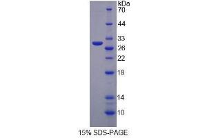 SDS-PAGE analysis of Human MPP3 Protein. (MPP3 蛋白)