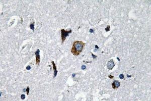 Immunohistochemistry (IHC) analyzes of ACE1 antibody in paraffin-embedded human brain tissue. (Angiotensin I Converting Enzyme 1 抗体)