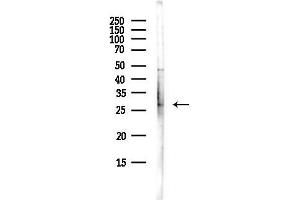 anti-Protein tyrosine Phosphatase-Like A Domain Containing 2 (PTPLAD2) antibody