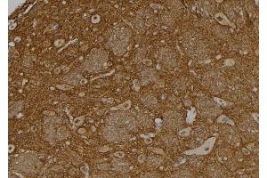 ABIN6273411 at 1/100 staining Rat brain tissue by IHC-P. (USP37 抗体  (Internal Region))