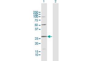 Western Blot analysis of C11orf17 expression in transfected 293T cell line by C11orf17 MaxPab polyclonal antibody. (AKIP1 抗体  (AA 1-210))