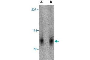 Western blot analysis of SLITRK2 in mouse brain tissue lysate with SLITRK2 polyclonal antibody  at (A) 1 and (B) 2 ug/mL . (SLITRK2 抗体  (Internal Region))