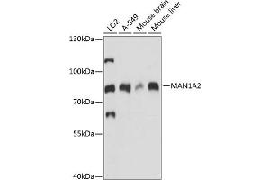 Western blot analysis of extracts of various cell lines, using M antibody (ABIN7268390) at 1:1000 dilution. (MAN1A2 抗体  (AA 60-180))