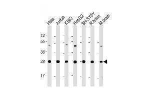 All lanes : Anti-HSD17B10 Antibody (Center) at 1:2000 dilution Lane 1: Hela whole cell lysate Lane 2: Jurkat whole cell lysate Lane 3: K562 whole cell lysate Lane 4: HepG2 whole cell lysate Lane 5: SH-SY5Y whole cell lysate Lane 6: rat brain lysate Lane 7: mouse brain lysate Lysates/proteins at 20 μg per lane. (HSD17B10 抗体  (AA 140-172))