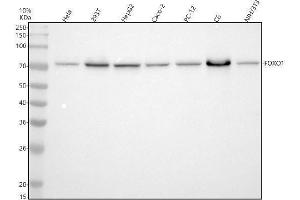 Western blot analysis of FOXO1 using anti-FOXO1 antibody (ABIN7604875).