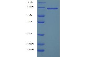 SDS-PAGE (SDS) image for Pyruvate Kinase, Liver and RBC (PKLR) (AA 1-574), (full length) protein (His tag) (ABIN5710103)