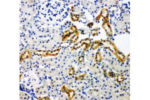 IHC-P: NOX4 antibody testing of rat kidney tissue (NADPH Oxidase 4 抗体  (C-Term))