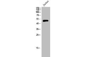 Western Blot analysis of JK cells using Septin 6 Polyclonal Antibody (Septin 6 抗体  (Internal Region))
