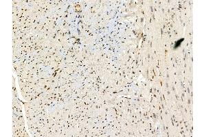 ABIN6257593 and ABIN6274990 at 1/100 staining Mouse heart tissue by IHC-P. (CEP57 抗体  (Internal Region))