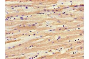 Immunohistochemistry (IHC) image for anti-Solute Carrier Family 25 (Mitochondrial Carrier, Adenine Nucleotide Translocator), Member 6 (SLC25A6) (AA 144-175) antibody (ABIN7143542)