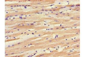 IHC image of ABIN7143542 diluted at 1:1200 and staining in paraffin-embedded human heart tissue performed on a Leica BondTM system.