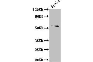 Western Blot Positive WB detected in: Mouse brain tissue All lanes: TRIM43 antibody at 3 μg/mL Secondary Goat polyclonal to rabbit IgG at 1/50000 dilution Predicted band size: 53 kDa Observed band size: 53 kDa (TRIM43 抗体  (AA 43-240))