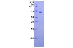 Image no. 2 for Mannose-Binding Lectin (Protein C) 2, Soluble (MBL2) (AA 130-248) (Active) protein (His tag,GST tag) (ABIN6239795)
