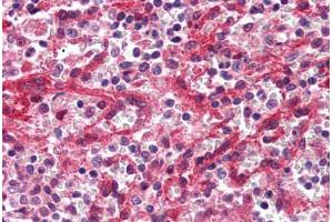 Human Spleen, Red Pulp (formalin-fixed, paraffin-embedded) stained with DARC antibody ABIN337034 at 2. (DARC 抗体  (C-Term))