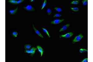 Immunofluorescence staining of A549 cells with ABIN7170140 at 1:66, counter-stained with DAPI.