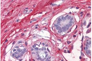 Human Breast: Formalin-Fixed, Paraffin-Embedded (FFPE) (Decorin 抗体  (AA 1-360))