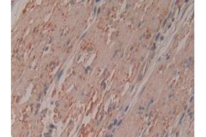 Immunohistochemistry (IHC) image for anti-Ribonuclease/angiogenin Inhibitor 1 (RNH1) (AA 218-444) antibody (ABIN7440089)