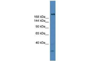 WB Suggested Anti-USP9Y Antibody Titration: 0. (USP9Y 抗体  (C-Term))