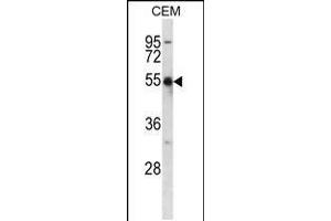 Western blot analysis in CEM cell line lysates (35ug/lane). (KCNA2 抗体  (C-Term))