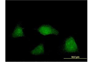 Immunofluorescence of monoclonal antibody to NUAK2 on HeLa cell. (NUAK2 抗体  (AA 521-628))
