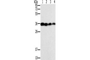 Western Blotting (WB) image for anti-Centromere Protein V (CENPV) antibody (ABIN2433633) (CENPV 抗体)