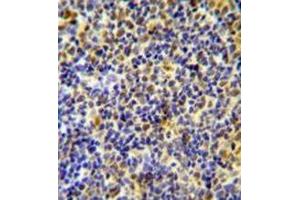 Immunohistochemistry analysis in formalin fixed and paraffin embedded human tonsil tissue using IKZF1/IKAROS Antibody (C-term), followed by peroxidase conjugation of the secondary antibody and DAB staining. (IKZF1 抗体  (C-Term))