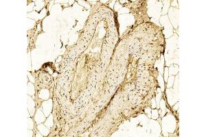 Immunohistochemical analysis of paraffin-embedded Human Skeletal muscle section using Pink1 (ABIN6242381 and ABIN6577241). (Hexokinase 2 抗体  (AA 1-170))