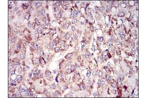 Immunohistochemistry (IHC) image for anti-Tubulin, epsilon 1 (TUBE1) (AA 314-472) antibody (ABIN5542399)