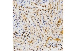Immunohistochemistry (IHC) image for anti-Histone 3 (H3) (C-Term) antibody (ABIN3023243)