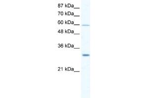 DDX31 antibody used at 2. (DDX31 抗体)