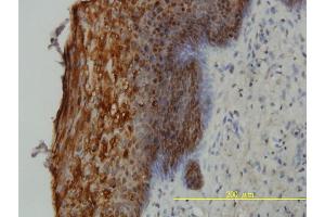 Immunoperoxidase of monoclonal antibody to SFN on formalin-fixed paraffin-embedded human uterine cervix tissue. (14-3-3 sigma/SFN 抗体  (AA 1-248))