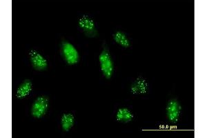 Immunofluorescence of purified MaxPab antibody to CENPB on HeLa cell. (CENPB 抗体  (AA 1-599))
