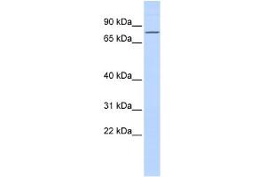 WB Suggested Anti-ZNF354A Antibody Titration:  0. (ZNF354A 抗体  (Middle Region))
