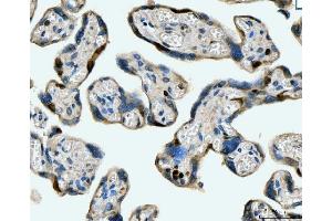 IHC analysis of MCM6 using anti-MCM6 antibody (ABIN7600038). (MCM6 抗体  (AA 14-821))