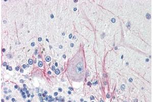 Human Brain, Cerebellum (formalin-fixed, paraffin-embedded) stained with DNASE2 antibody ABIN214485 at 5 ug/ml followed by biotinylated goat anti-rabbit IgG secondary antibody ABIN481713, alkaline phosphatase-streptavidin and chromogen. (DNASE2 抗体  (AA 347-360))