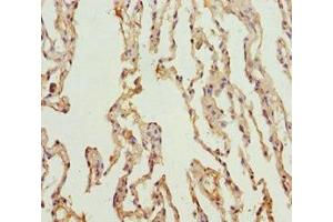 Immunohistochemistry of paraffin-embedded human lung tissue using ABIN7164013 at dilution of 1:100 (KCNS3 抗体  (AA 1-180))