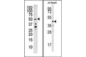 Image no. 1 for anti-Dual Specificity Phosphatase 10 (DUSP10) (N-Term) antibody (ABIN360788) (DUSP10 抗体  (N-Term))