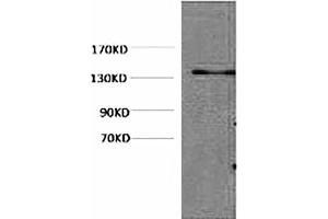Western blot analysis of Hela, diluted at 1:1000. (HSV Tag 抗体)