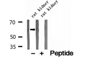 Western blot analysis of extracts of rat kidney tissue, using CKAP4 antibody. (CKAP4 抗体  (C-Term))