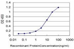 Detection limit for recombinant GST tagged KLF6 is approximately 0. (KLF6 抗体  (AA 1-100))