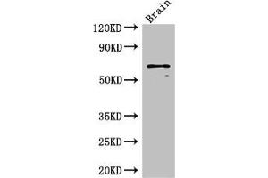 Western Blot Positive WB detected in: Mouse brain tissue All lanes: SLC6A3 antibody at 3 μg/mL Secondary Goat polyclonal to rabbit IgG at 1/50000 dilution Predicted band size: 69 kDa Observed band size: 69 kDa (SLC6A3 抗体  (AA 161-237))