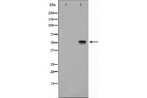 Western blot analysis of NK1R expression in Mouse lung lysate The lane on the left is treated with the antigen-specific peptide. (TACR1 抗体  (Internal Region))