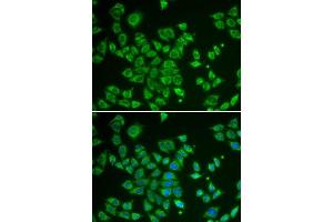 Immunofluorescence analysis of HeLa cells using SMAD1 antibody.
