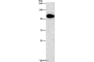 Western blot analysis of Mouse brain tissue, using DNM3 Polyclonal Antibody at dilution of 1:500 (Dynamin 3 抗体)